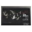 [ ❎ ---- Sold Out ---- ❎ ] [ จัดส่งแล้ว PD285677634TH - คุณเพ็ญพิมล ] 🌑 CD แผ่นคู่ : วงไมโคร The 25 Years Hits Collection : 25 ปีแห่งตำนานมือขวา