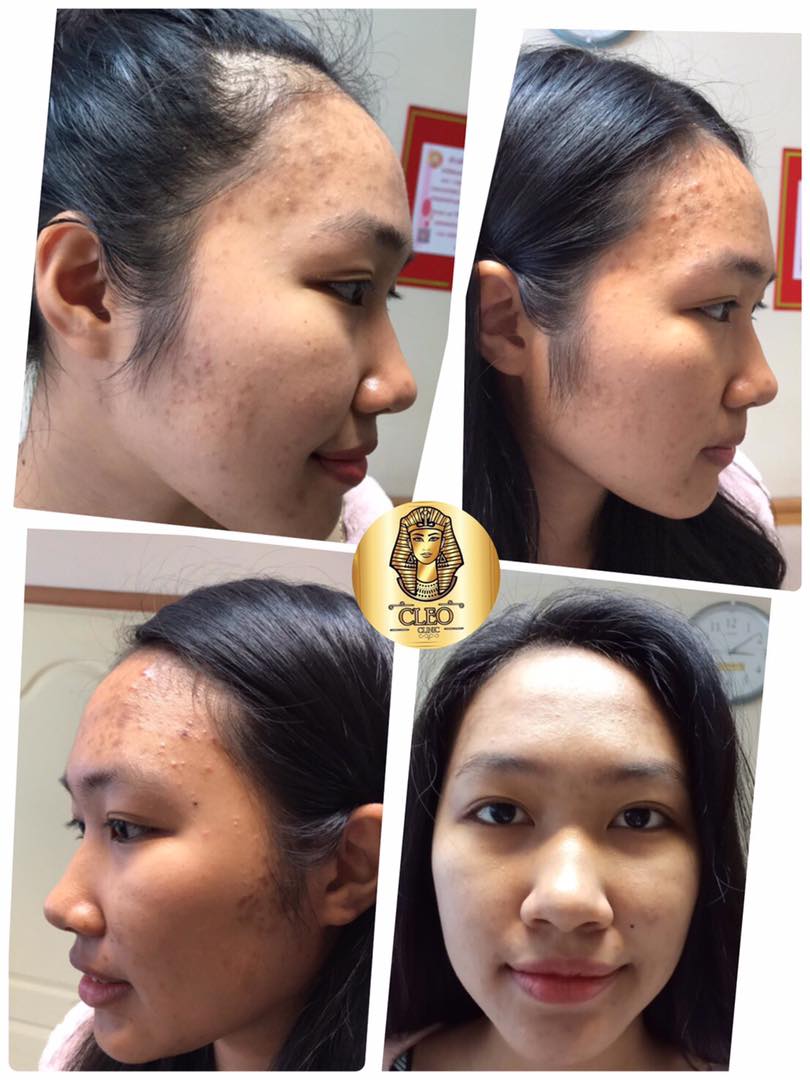 รีวิว ปี 62