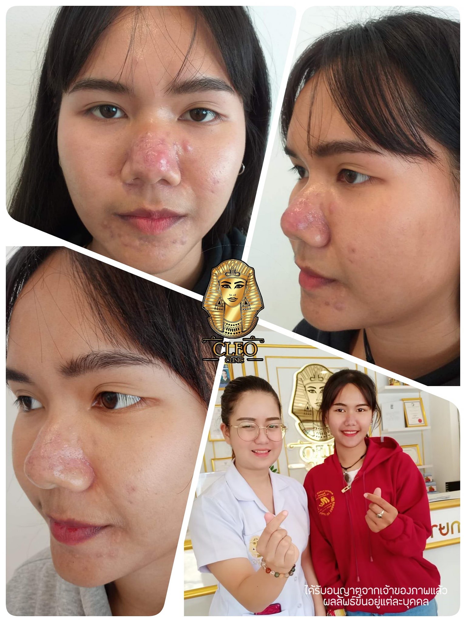 รีวิว ปี 62