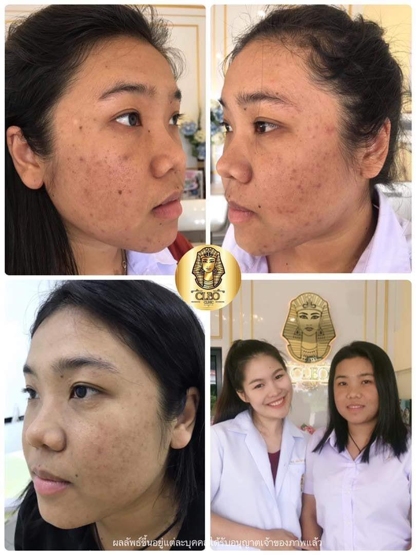 รีวิว ปี 62