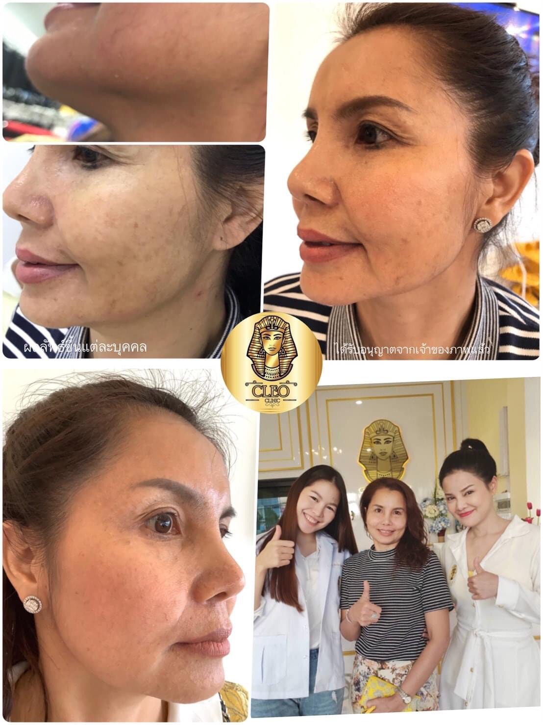 รีวิว ปี 62