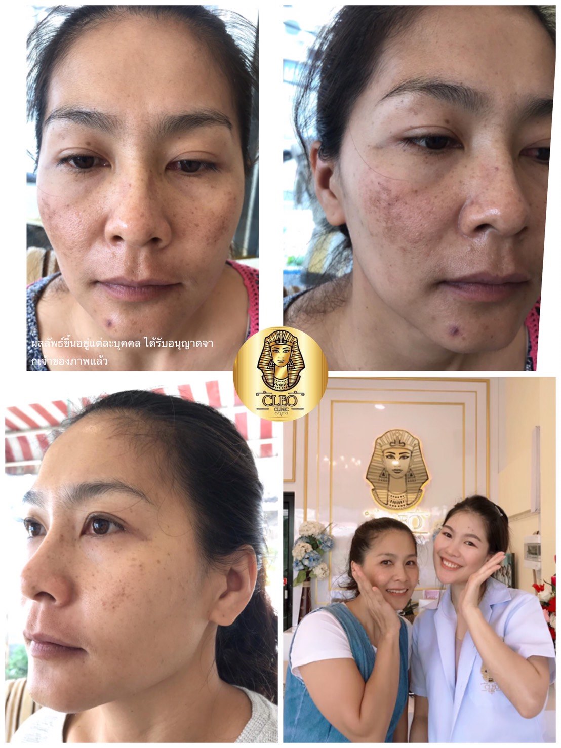 รีวิว ปี 62