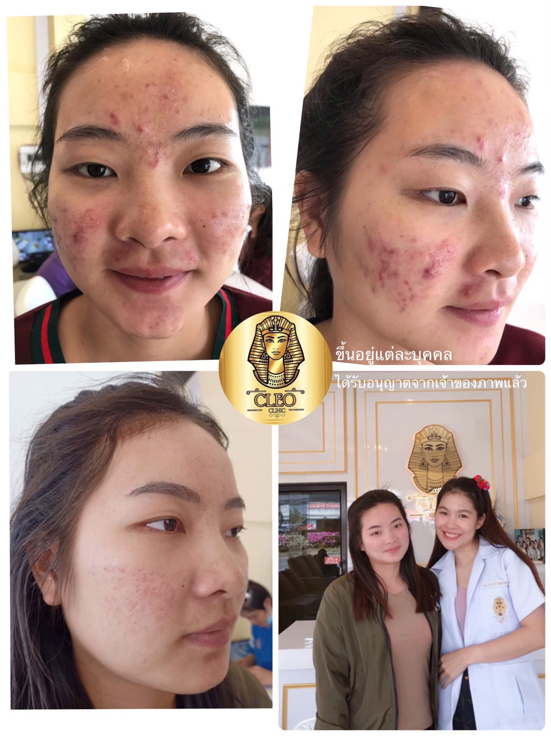 รีวิว ปี 62