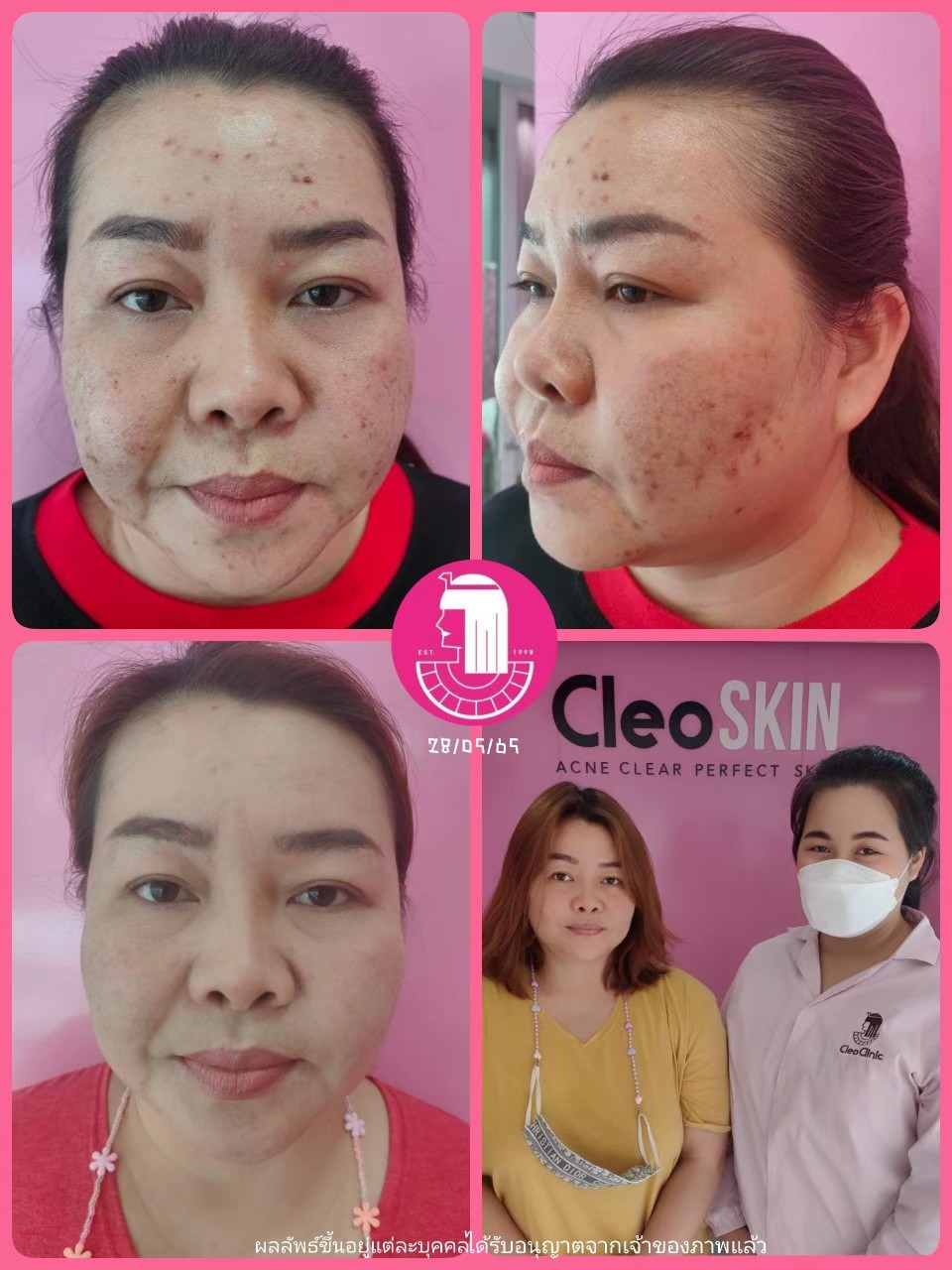 รีวิว ปี 62