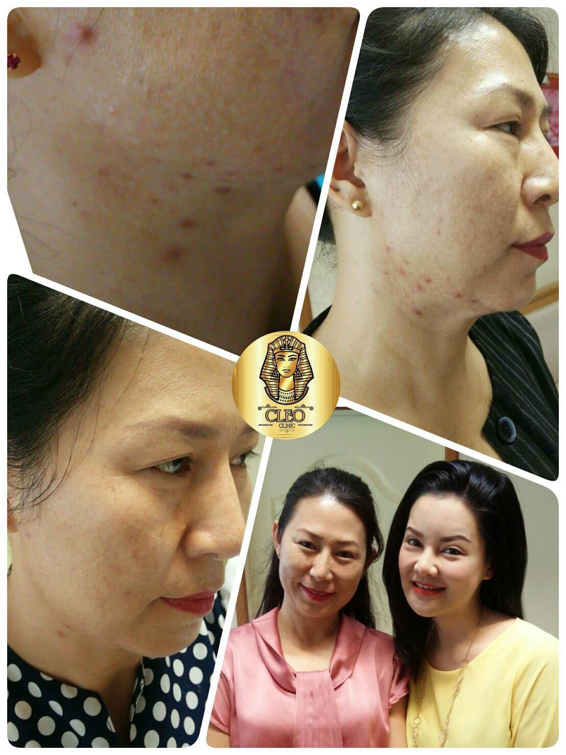 รีวิว ปี 62