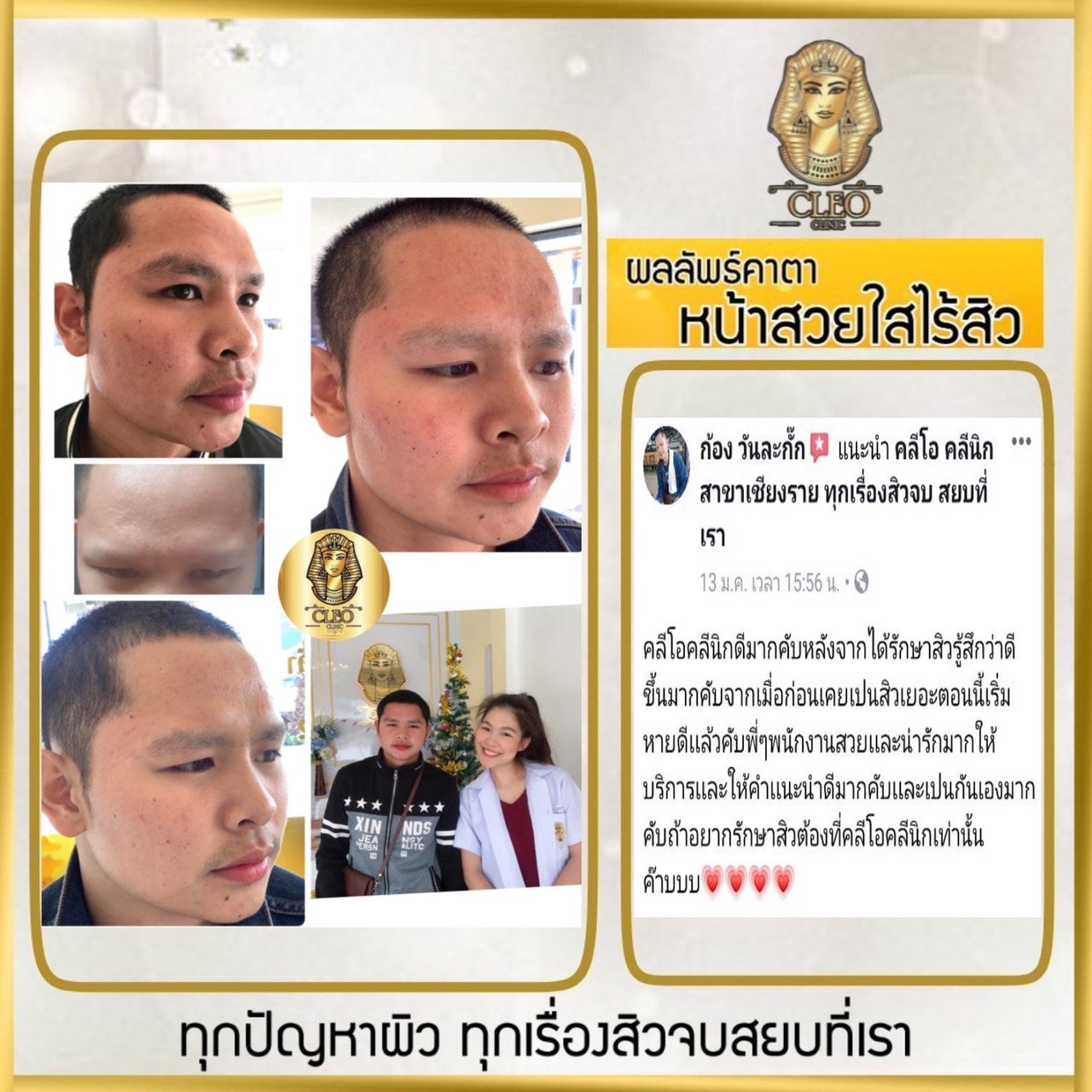 รีวิว ปี 62