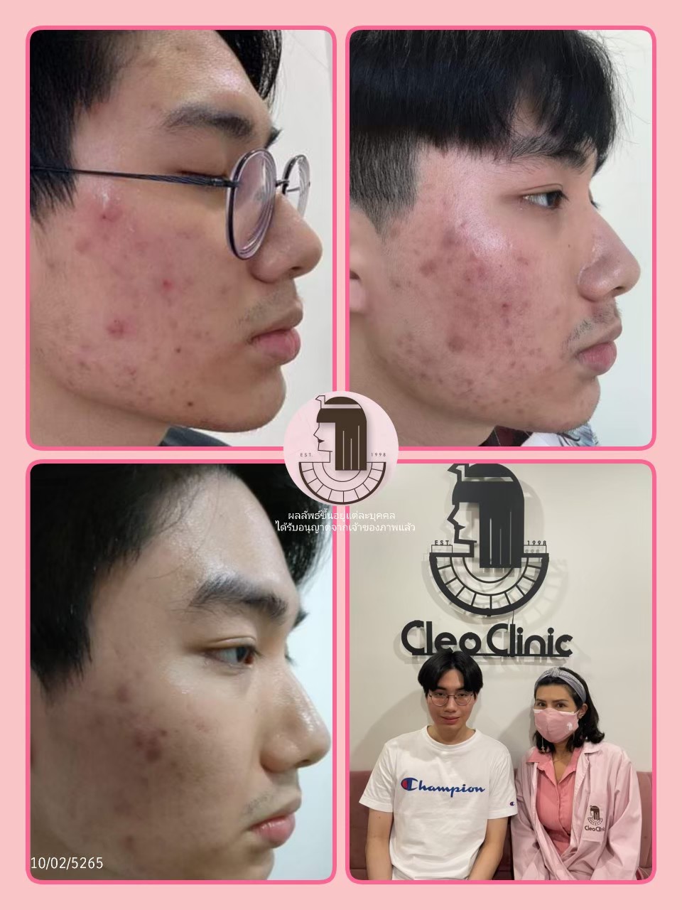 รีวิว ปี 62