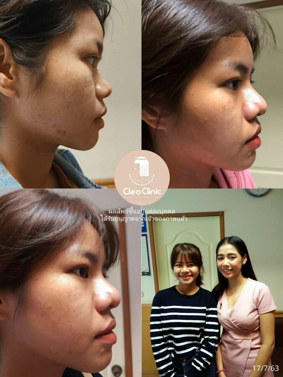 รีวิว ปี 62