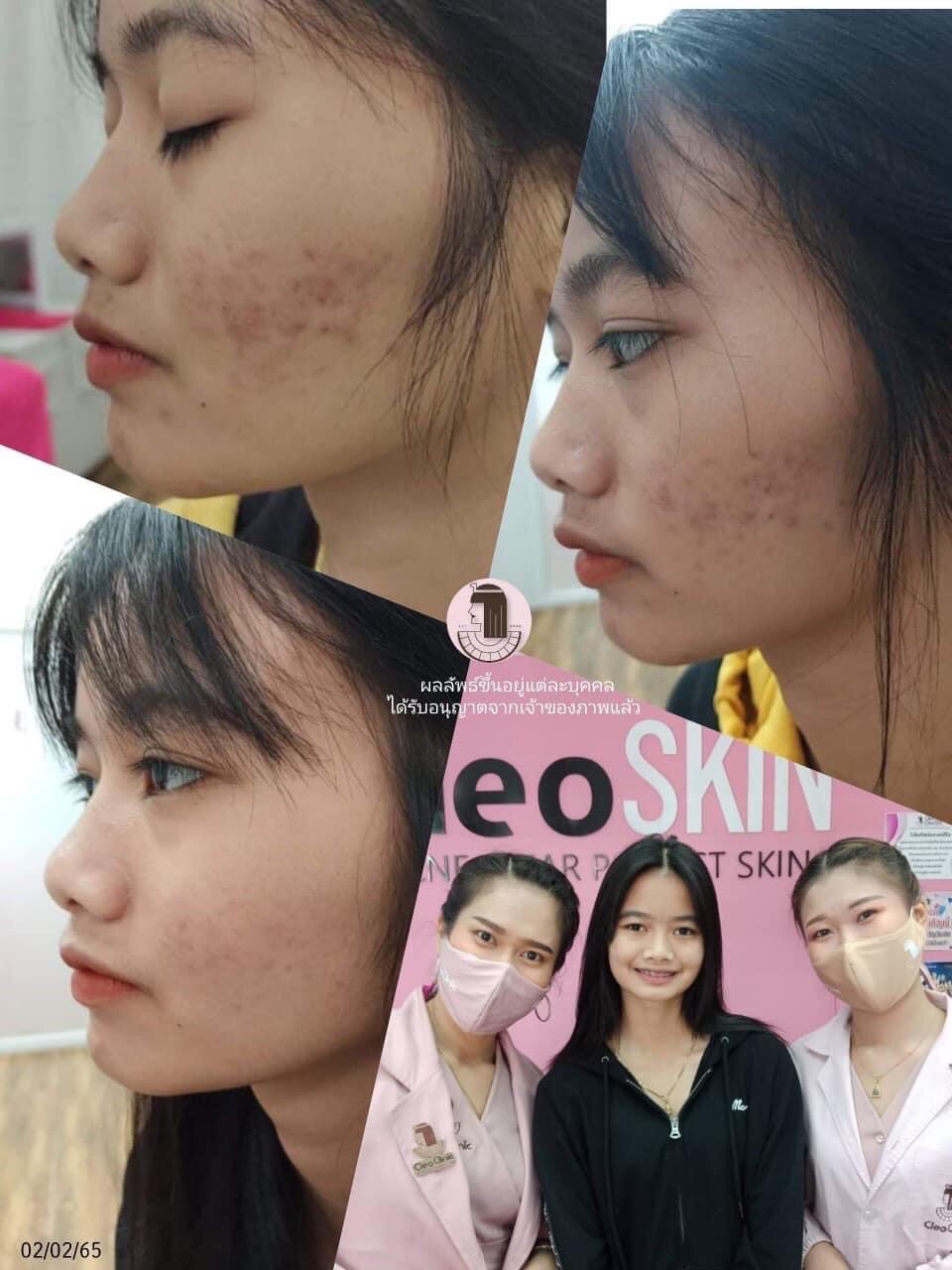 รีวิว ปี 62