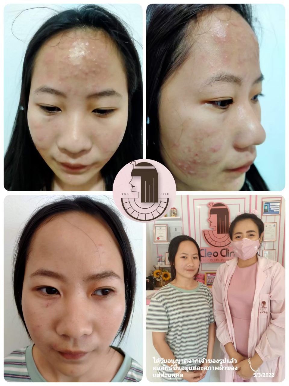 รีวิว ปี 62