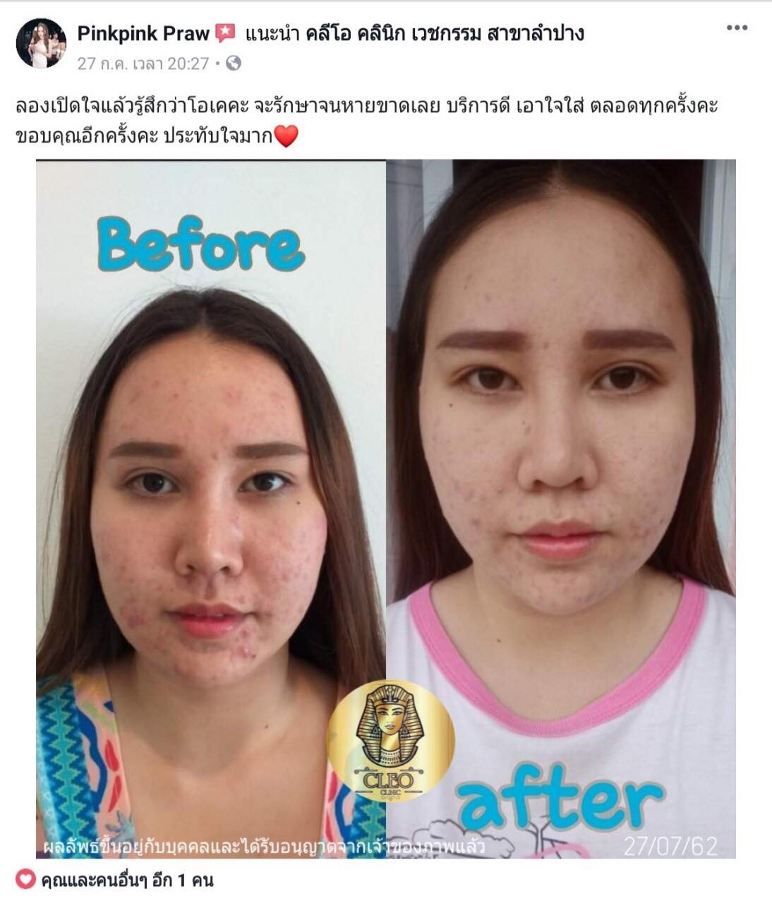 รีวิว ปี 62