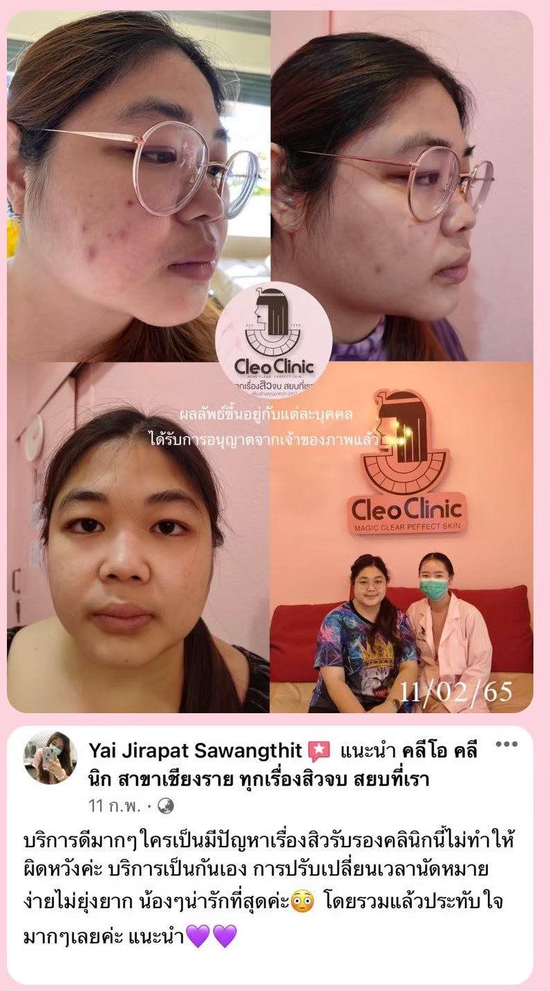 รีวิว ปี 62