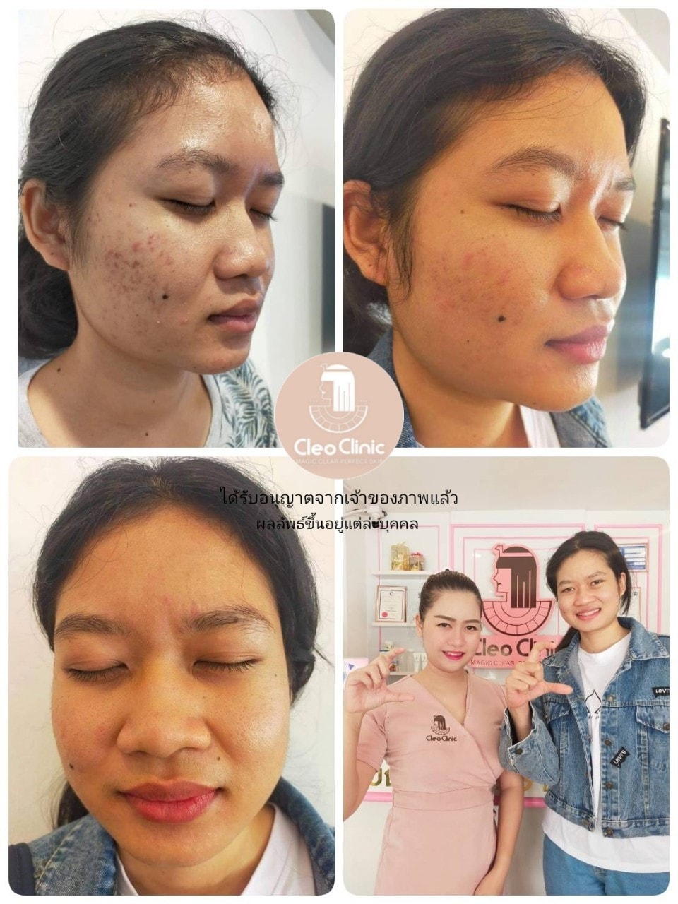 รีวิว ปี 62