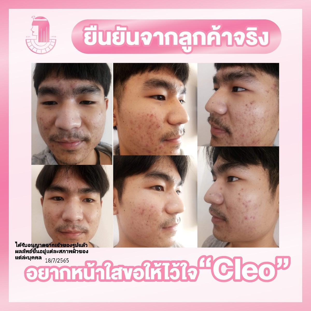 รีวิว ปี 62