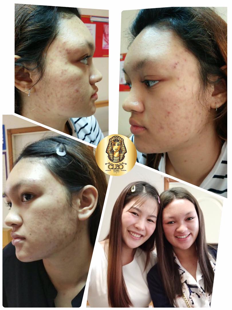 รีวิว ปี 62