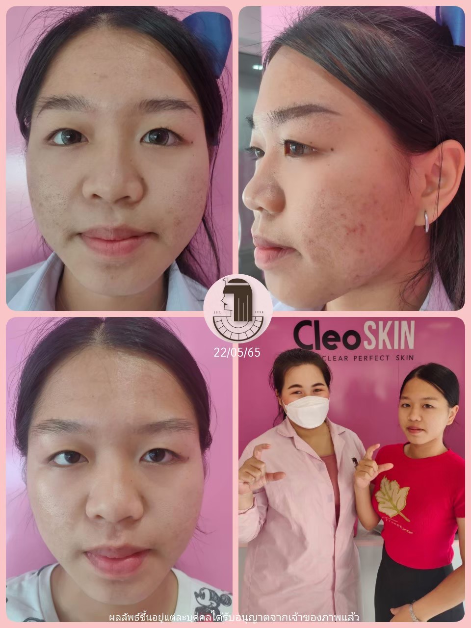 รีวิว ปี 62