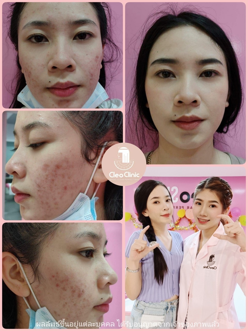 รีวิว ปี 62