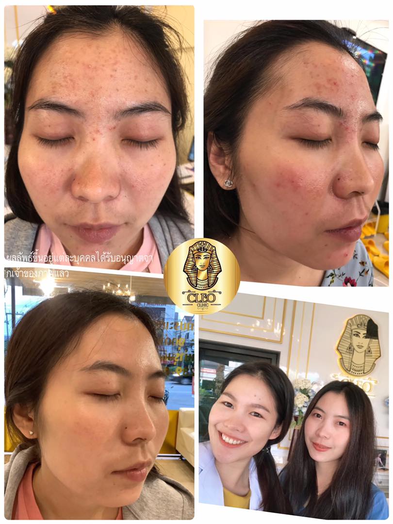 รีวิว ปี 62