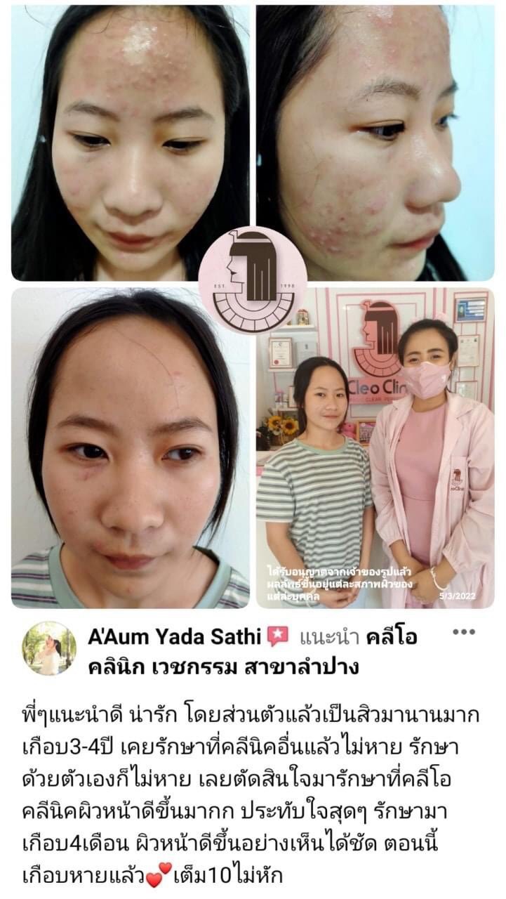 รีวิว ปี 62