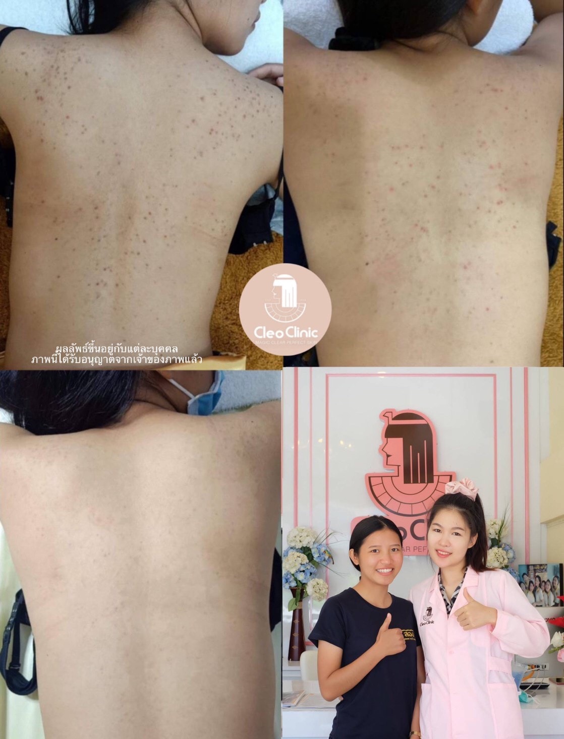 รีวิว ปี 62