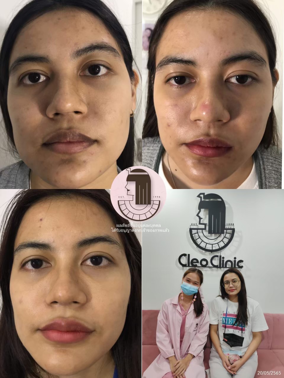 รีวิว ปี 62