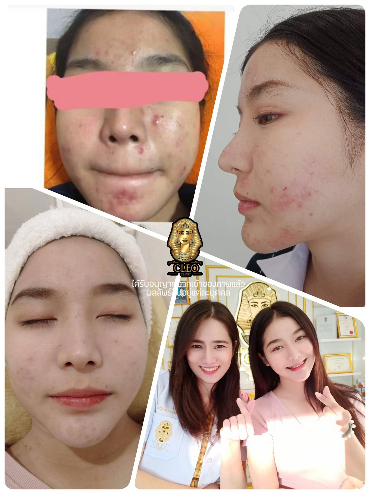 รีวิว ปี 62