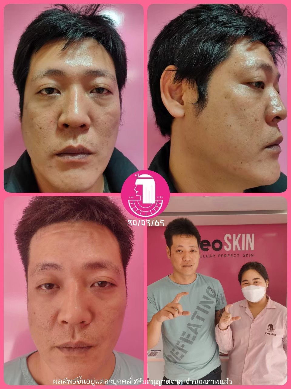 รีวิว ปี 62