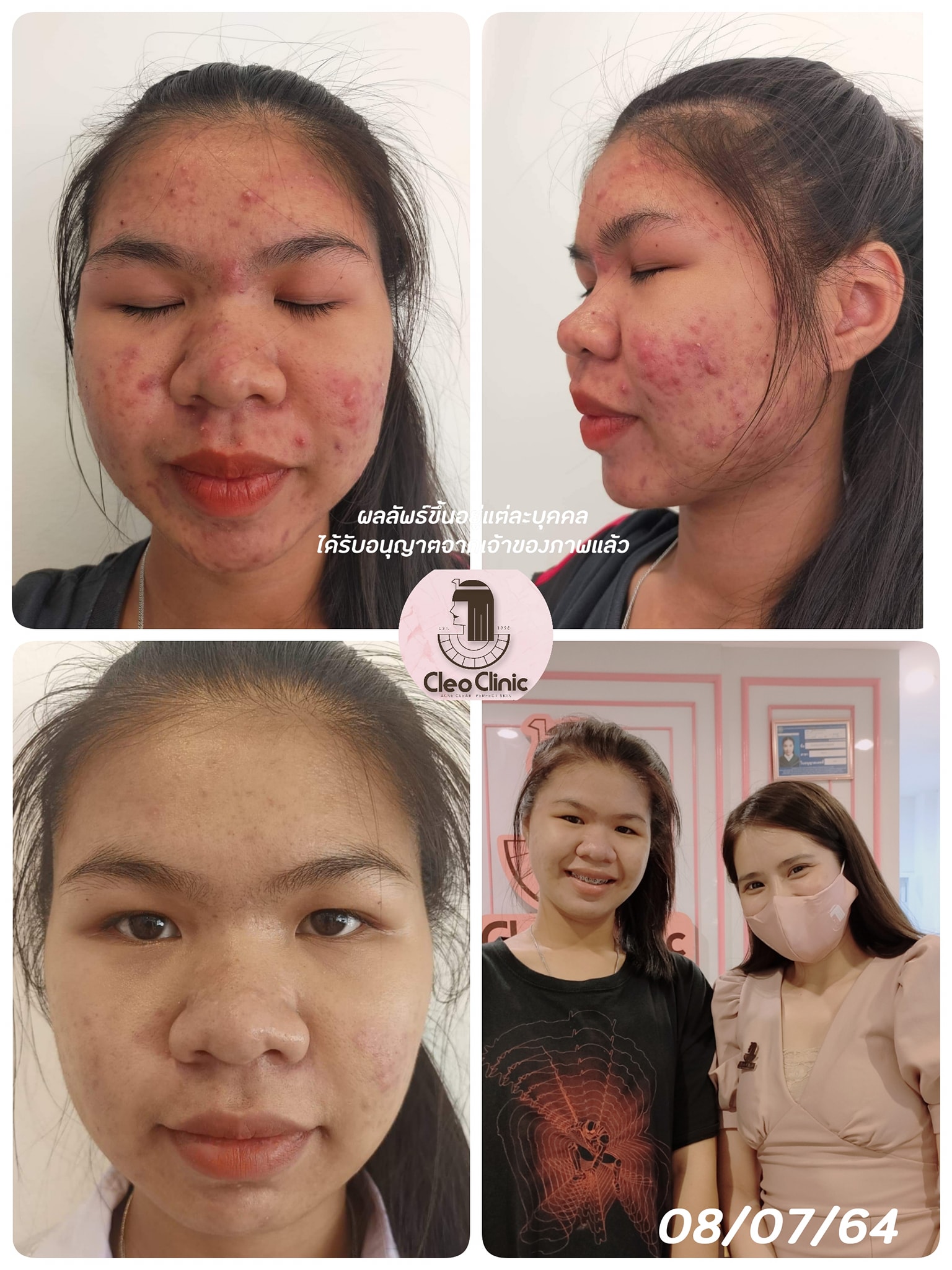 รีวิว ปี 62