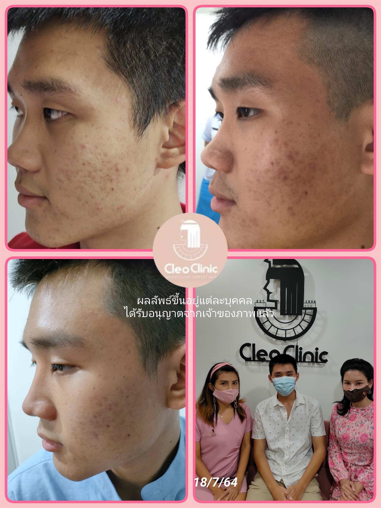 รีวิว ปี 62