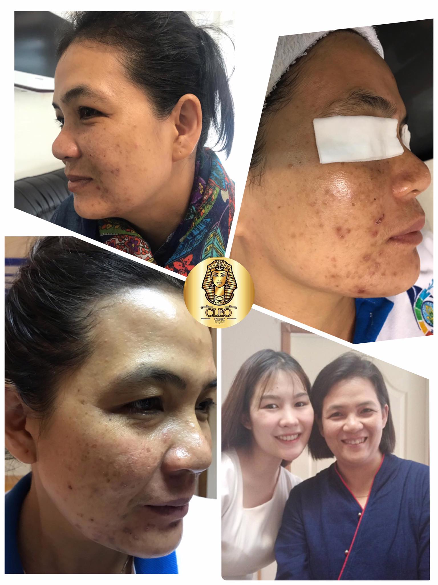 รีวิว ปี 62