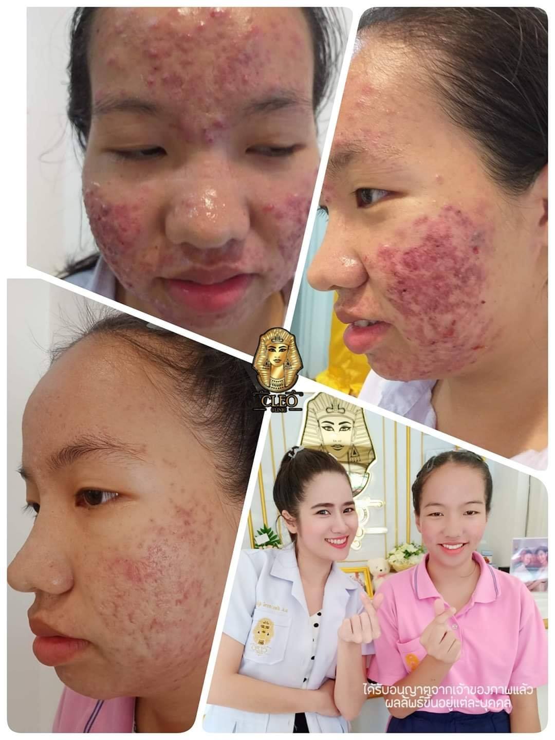 รีวิว ปี 62