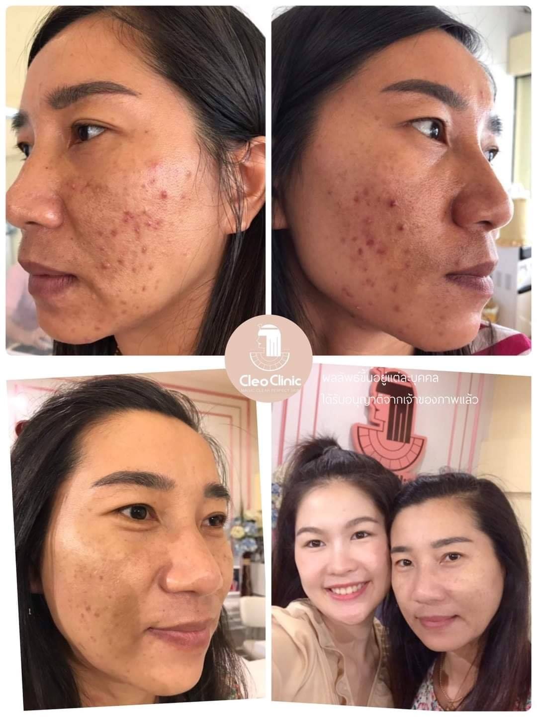 รีวิว ปี 62