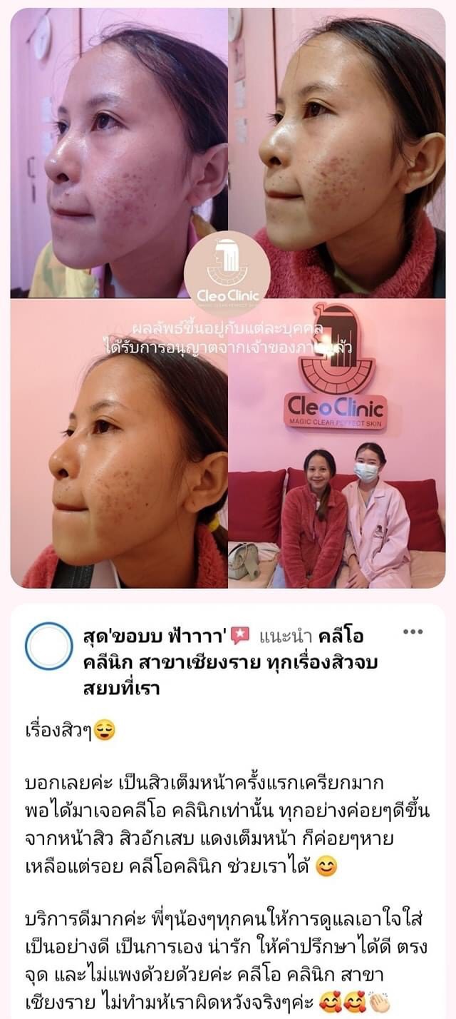 รีวิว ปี 62