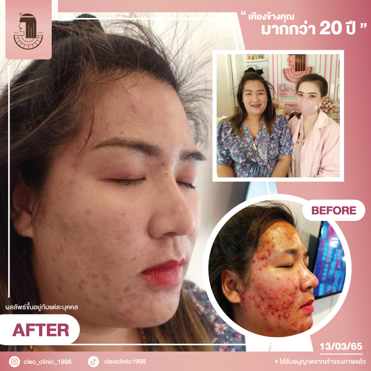 รีวิว ปี 62