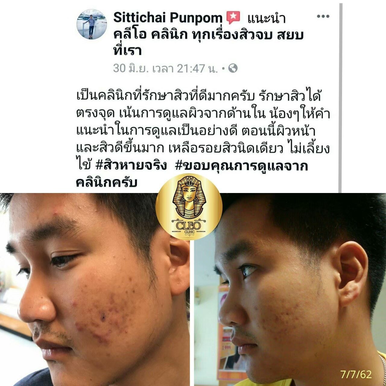 รีวิว ปี 62