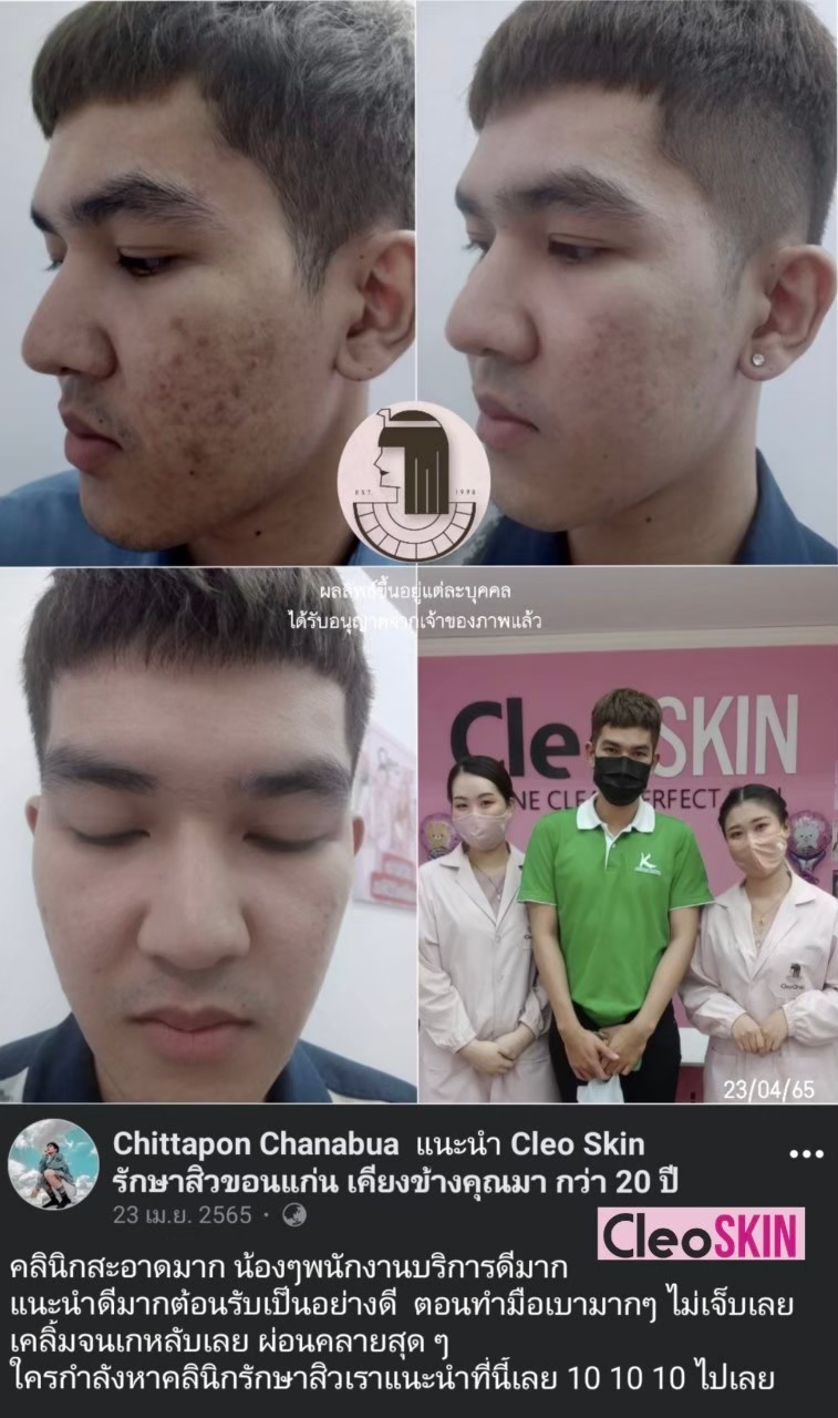 รีวิว ปี 62