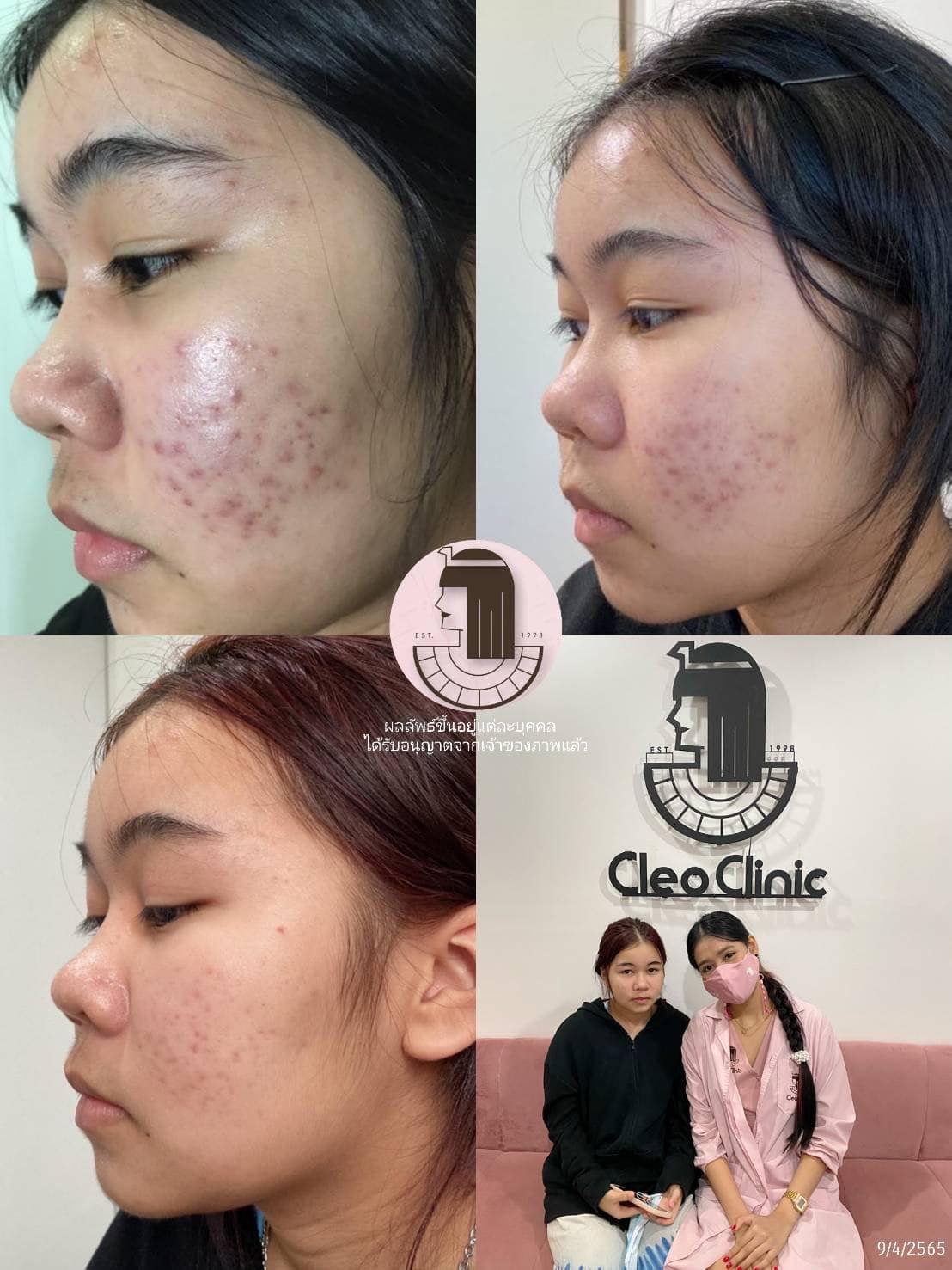 รีวิว ปี 62