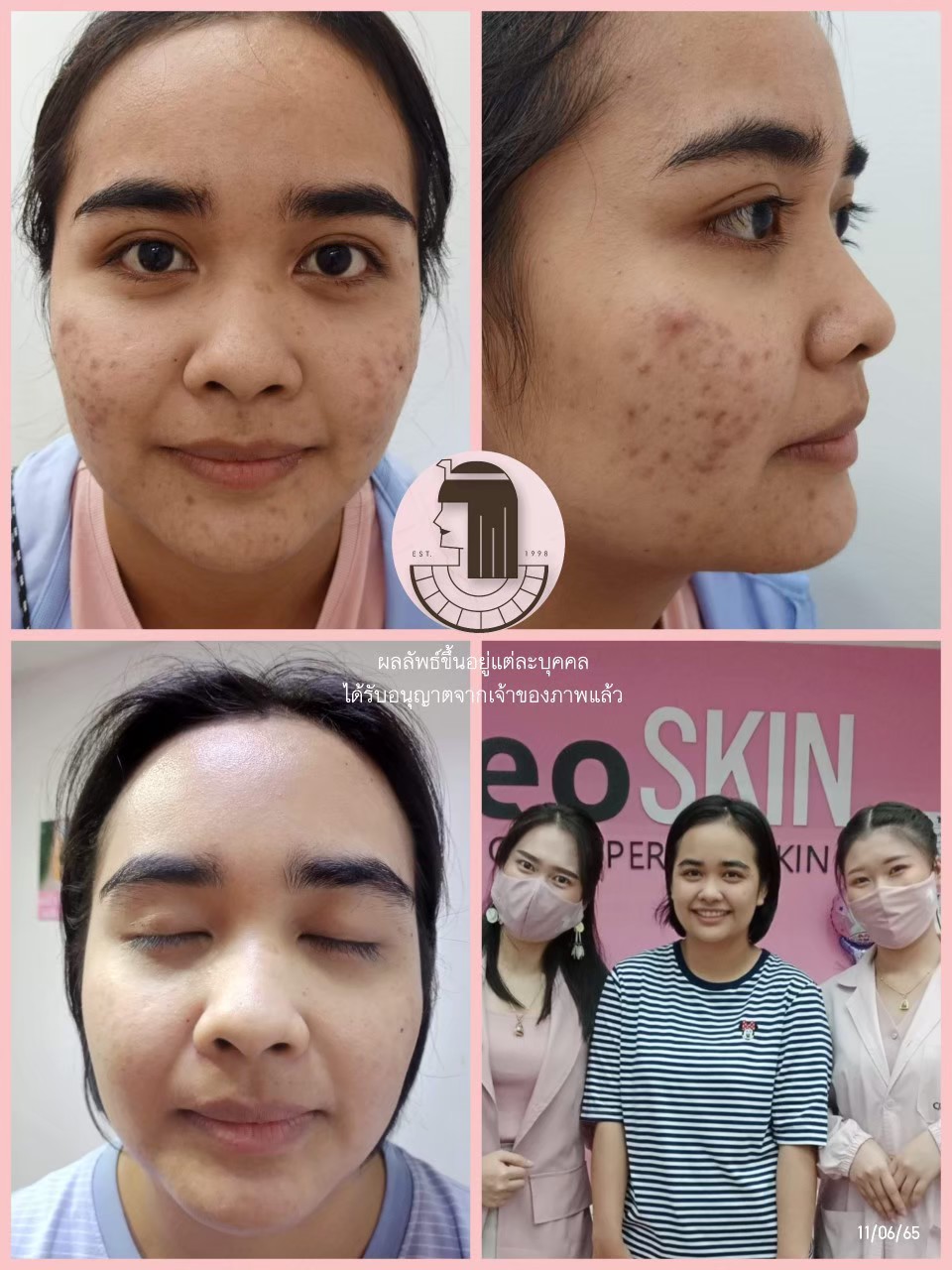 รีวิว ปี 62