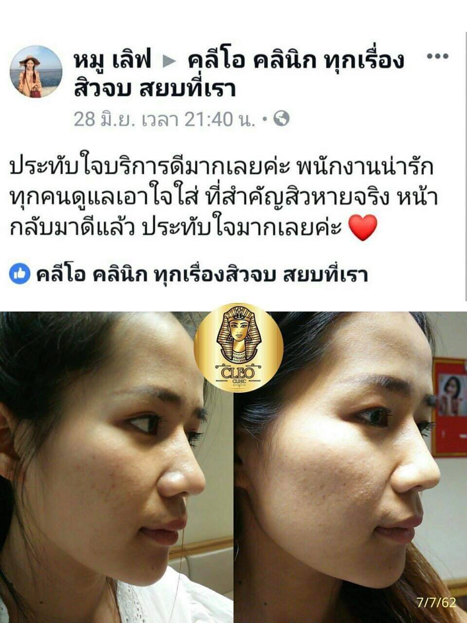 รีวิว ปี 62