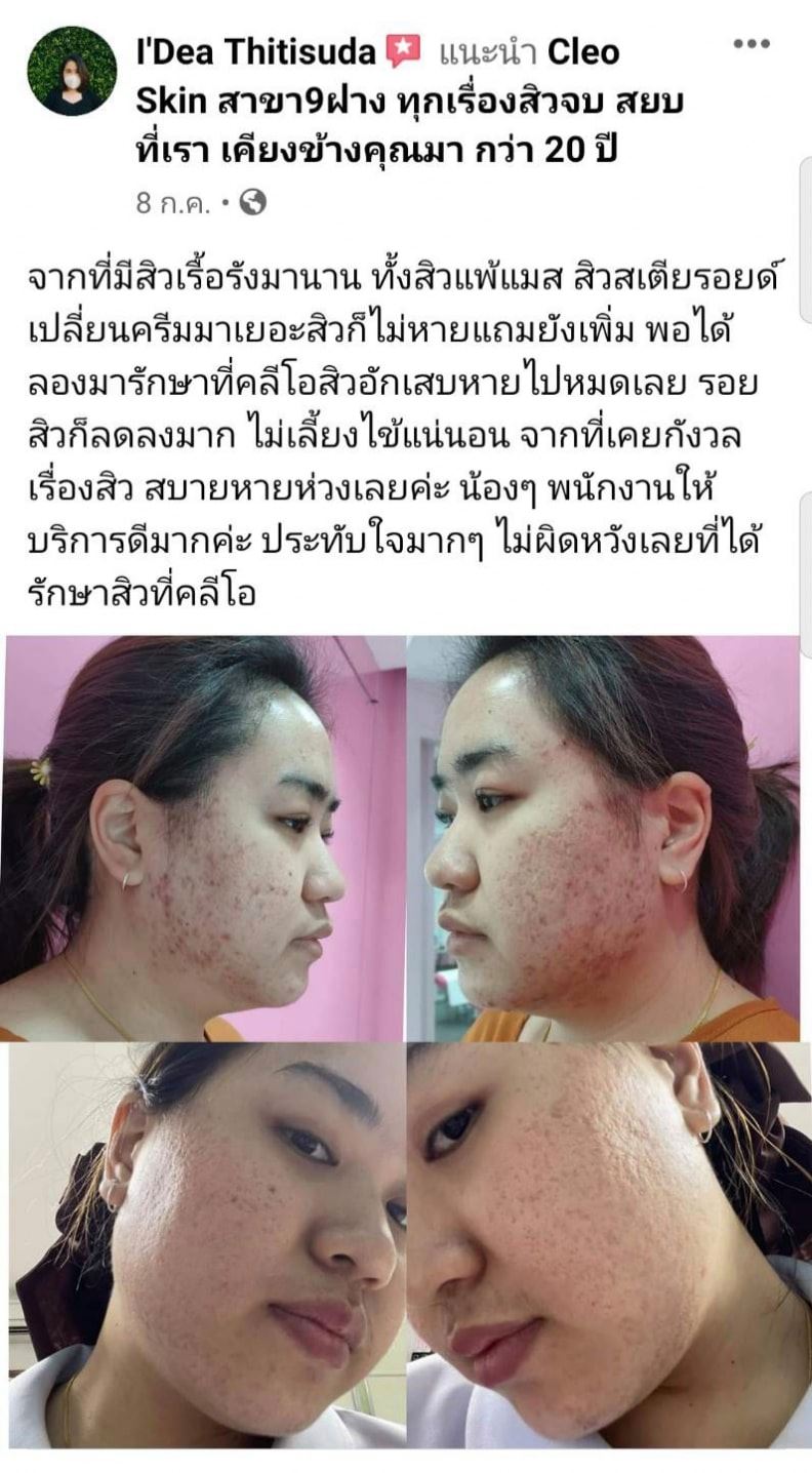 รีวิว ปี 62