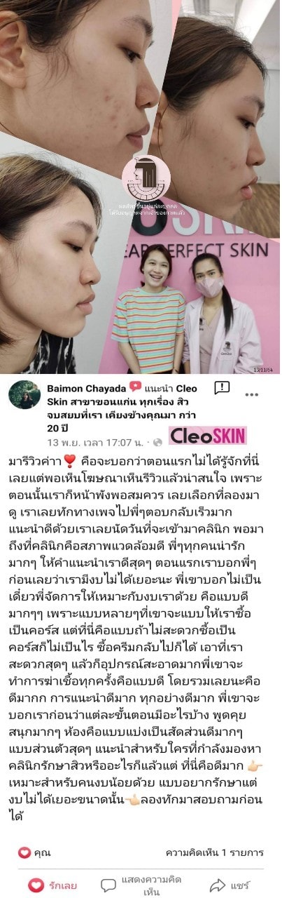 รีวิว ปี 62