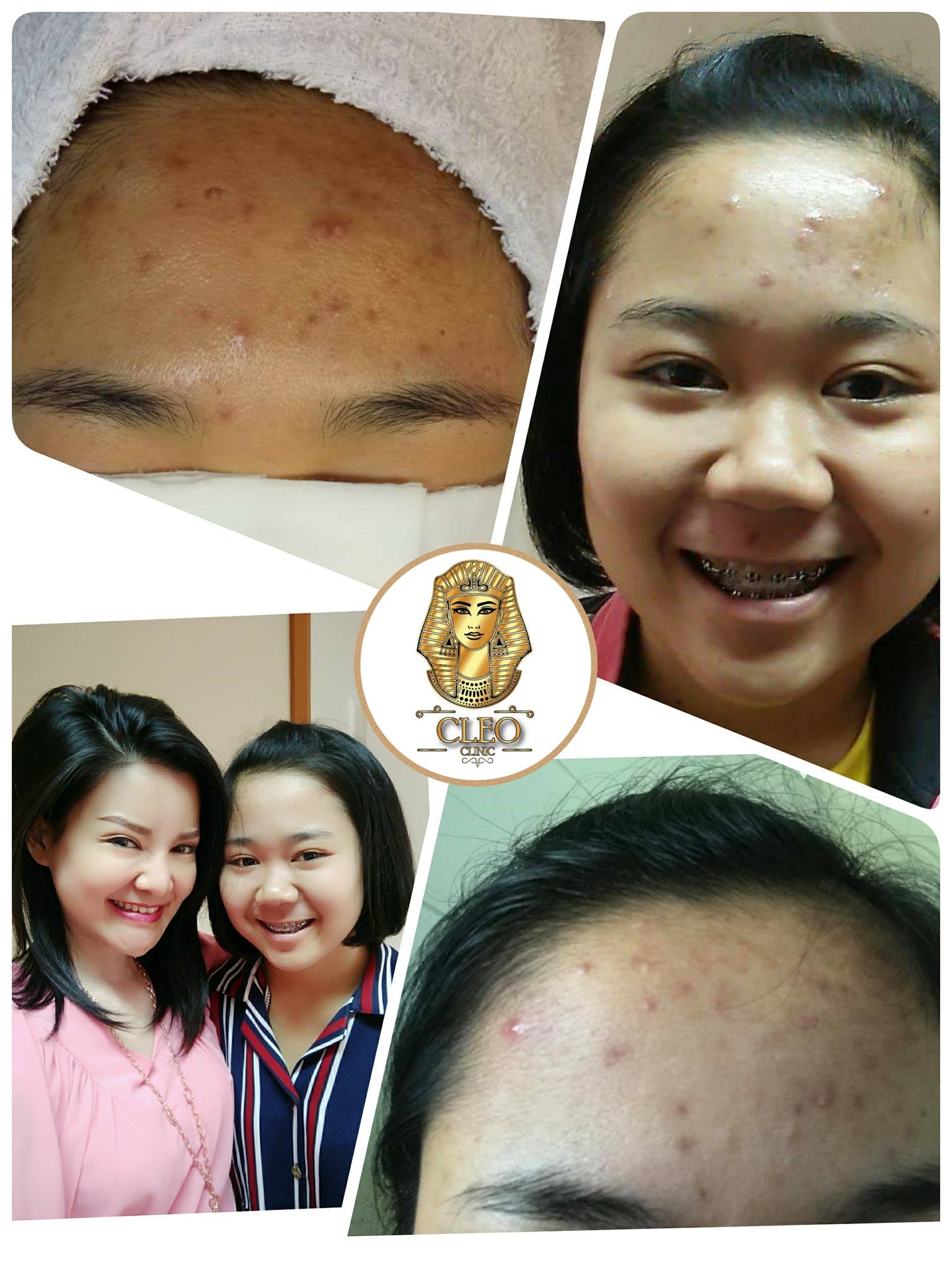 รีวิว ปี 62