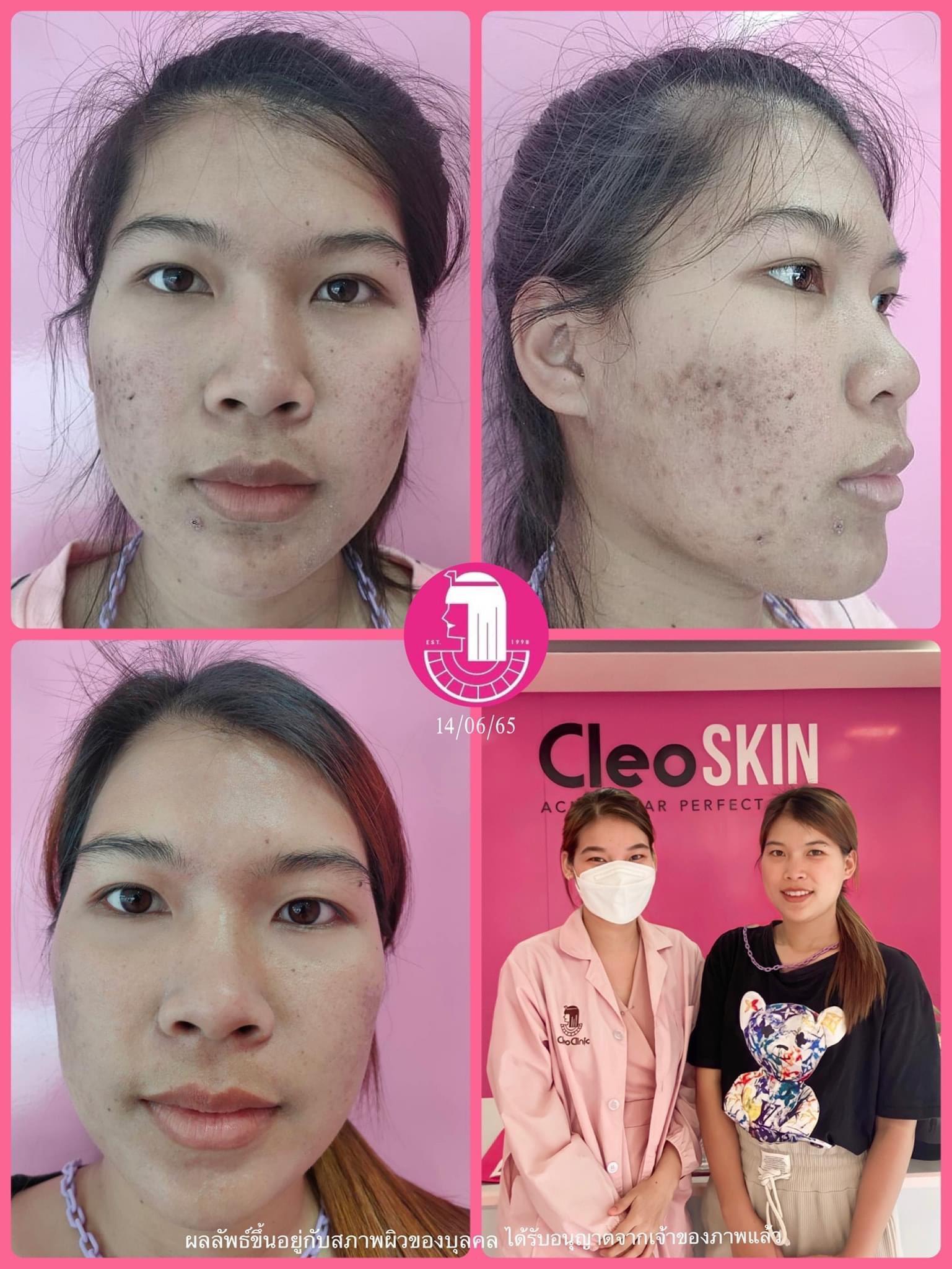 รีวิว ปี 62