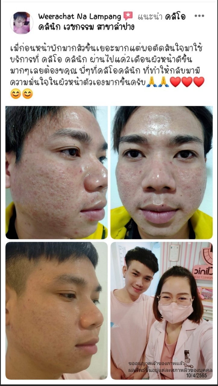 รีวิว ปี 62