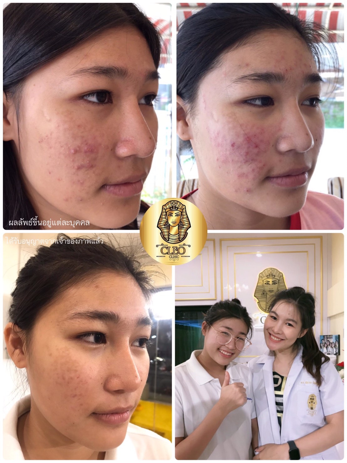 รีวิว ปี 62