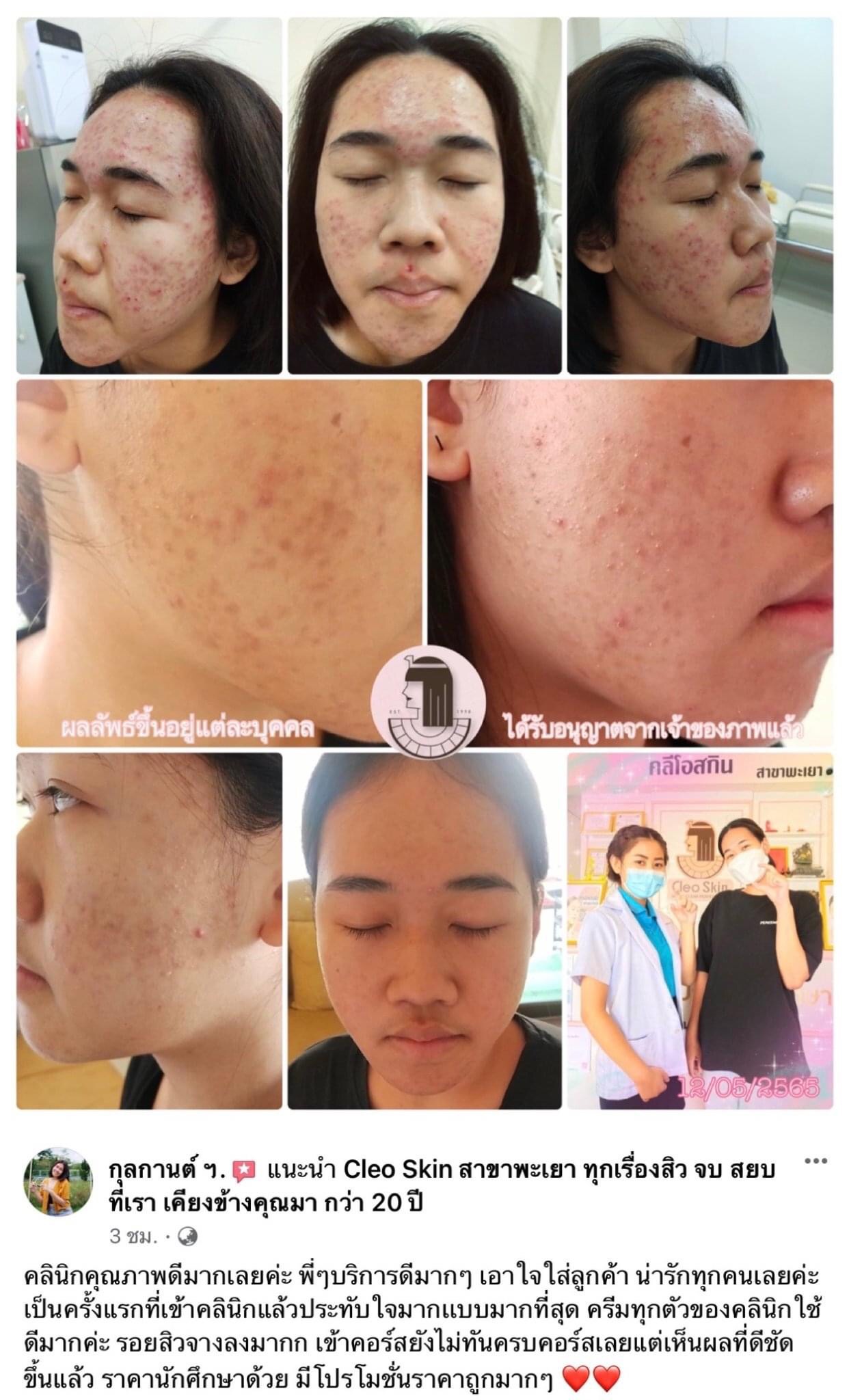 รีวิว ปี 62