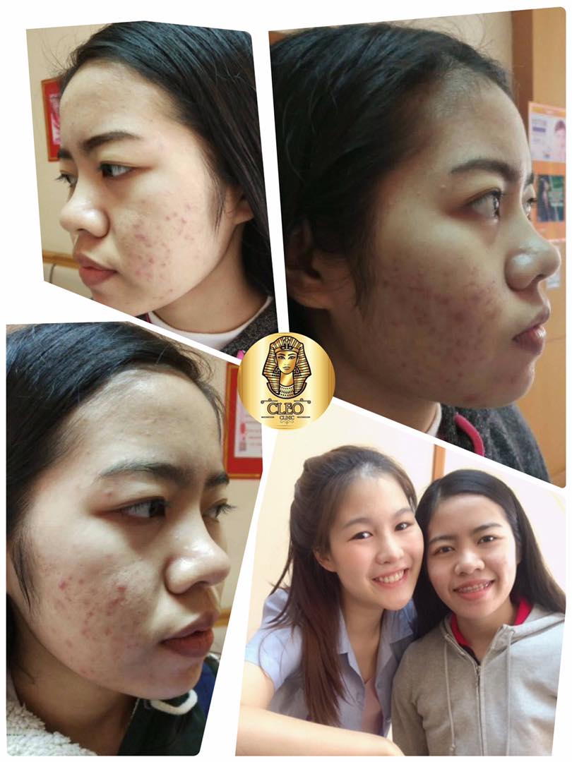 รีวิว ปี 62