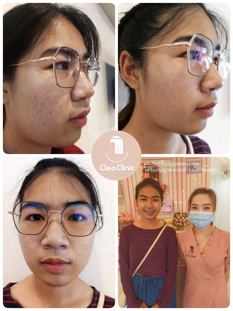 รีวิว ปี 62