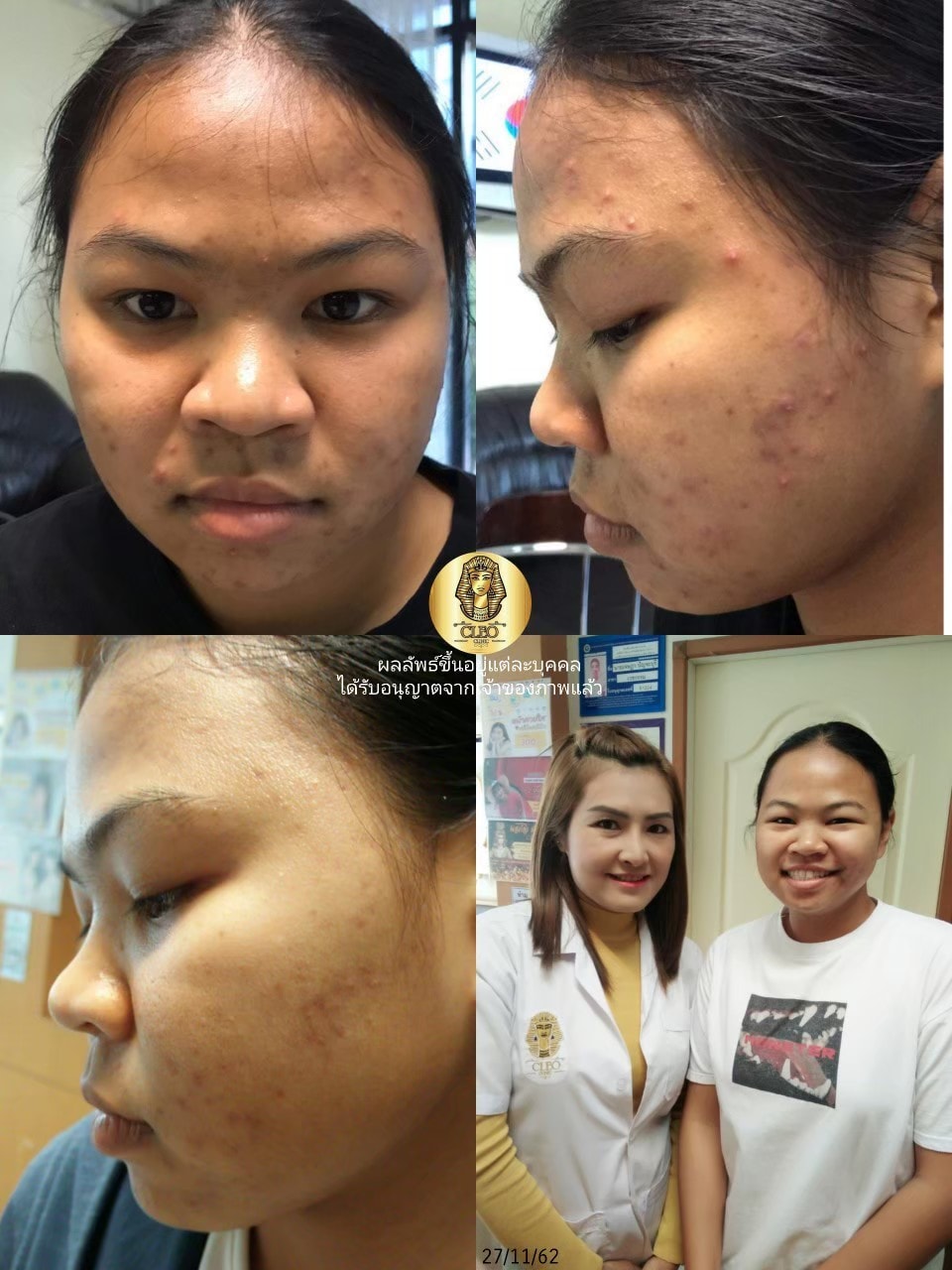 รีวิว ปี 62