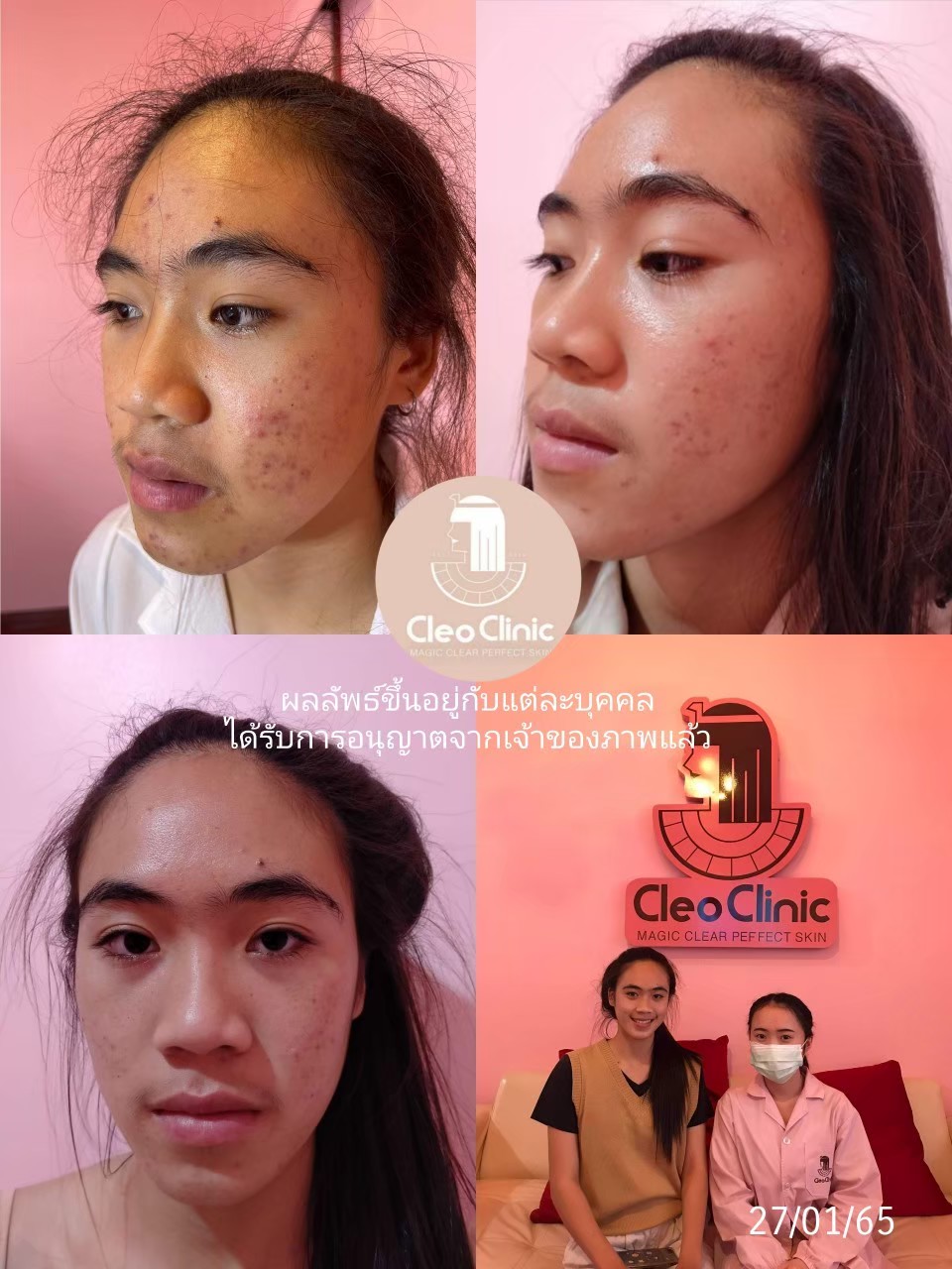 รีวิว ปี 62